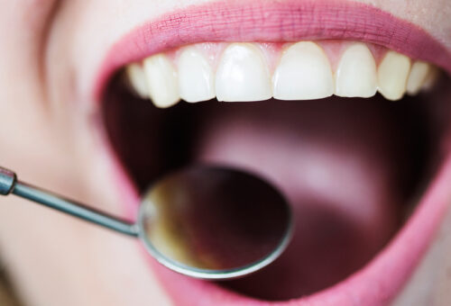 Imagen odontologia estética en Clinica dental Oropesa