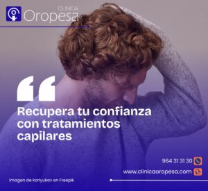 Imagen tratamiento capilar clínica Oropesa
